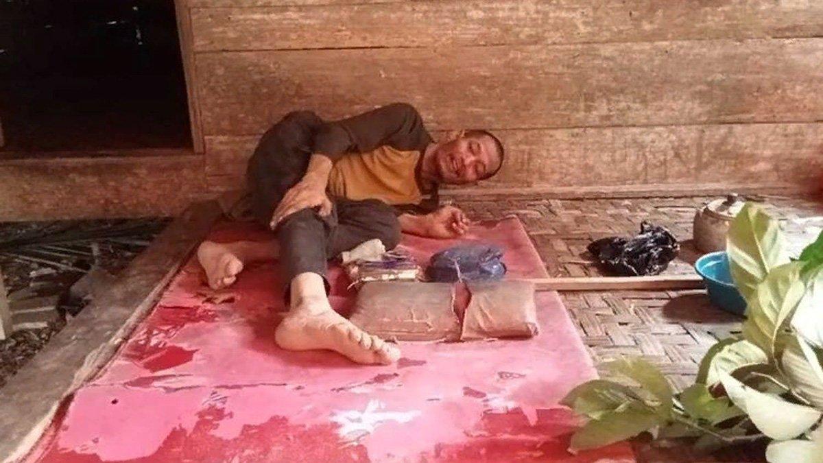 Satu keluarga di Kabupaten Lebak, Provinsi Banten mengalami kelumpuhan kaki.