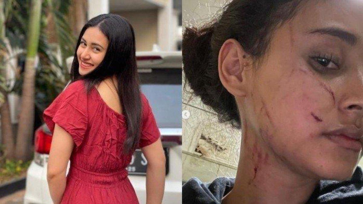 Selebgram Afifah Riyad dianiaya mantan pacar suami.