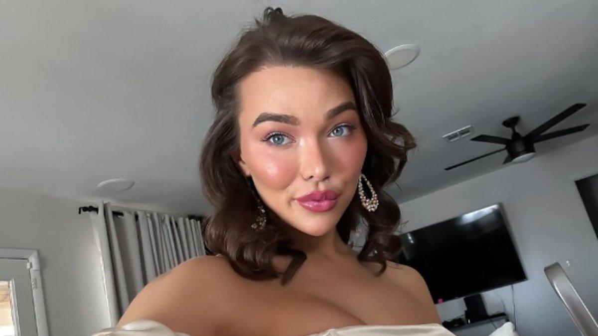 Selebgram Emma Rose nyaris kehilangan nyawa gegara operasi rahang
