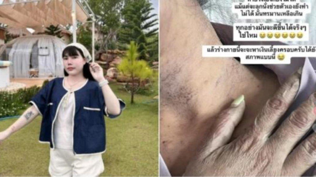 Seorang TikToker wanita asal Thailand mengidap penyakit kulit langka, meninggal dunia setelah dua bulan dirawat intensif