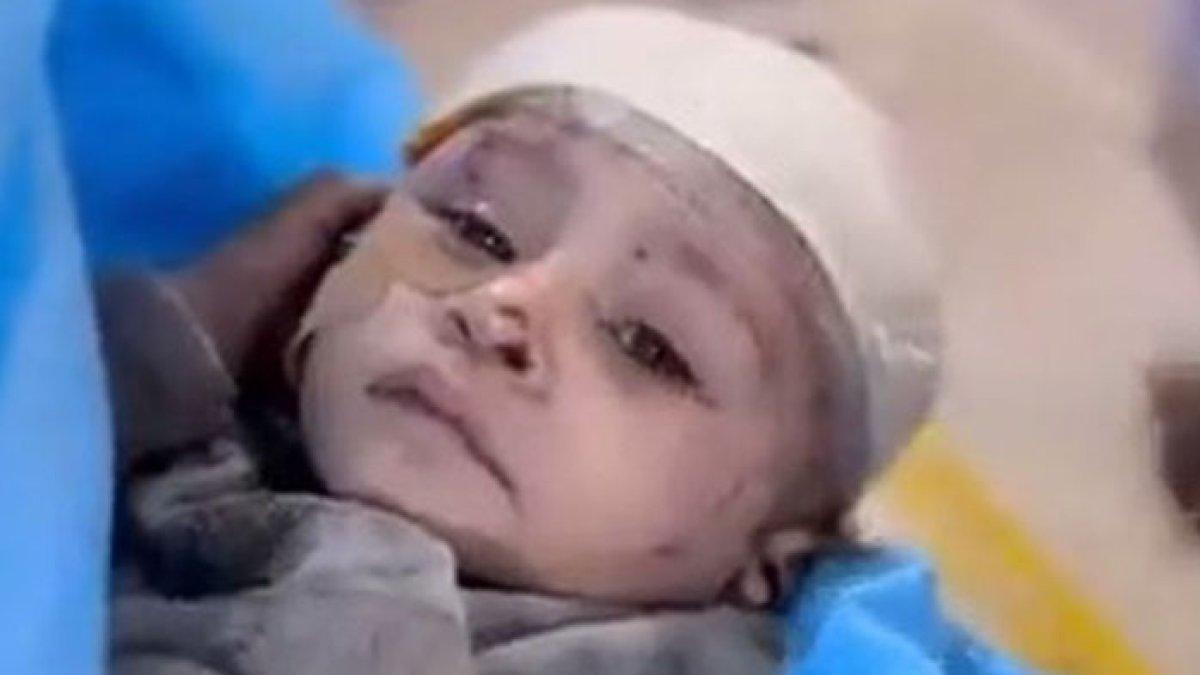 Seorang bayi bernama Noor Ahmed Ashour yang selamat dari tiga serangan Israel.