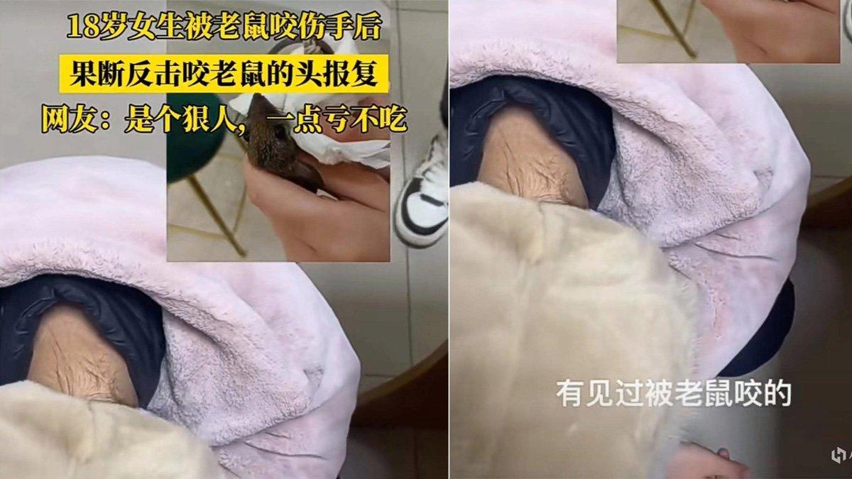 Seorang wanita gigit tikus sampai mati, dokter syok.