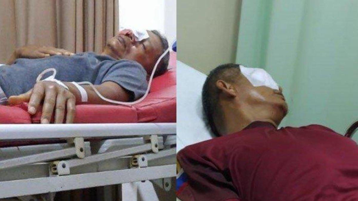 Sosok Zaharman Guru SMA Alami Buta Permanen Usai Diketapel Wali Murid, Kini Dirawat Secara Intensif