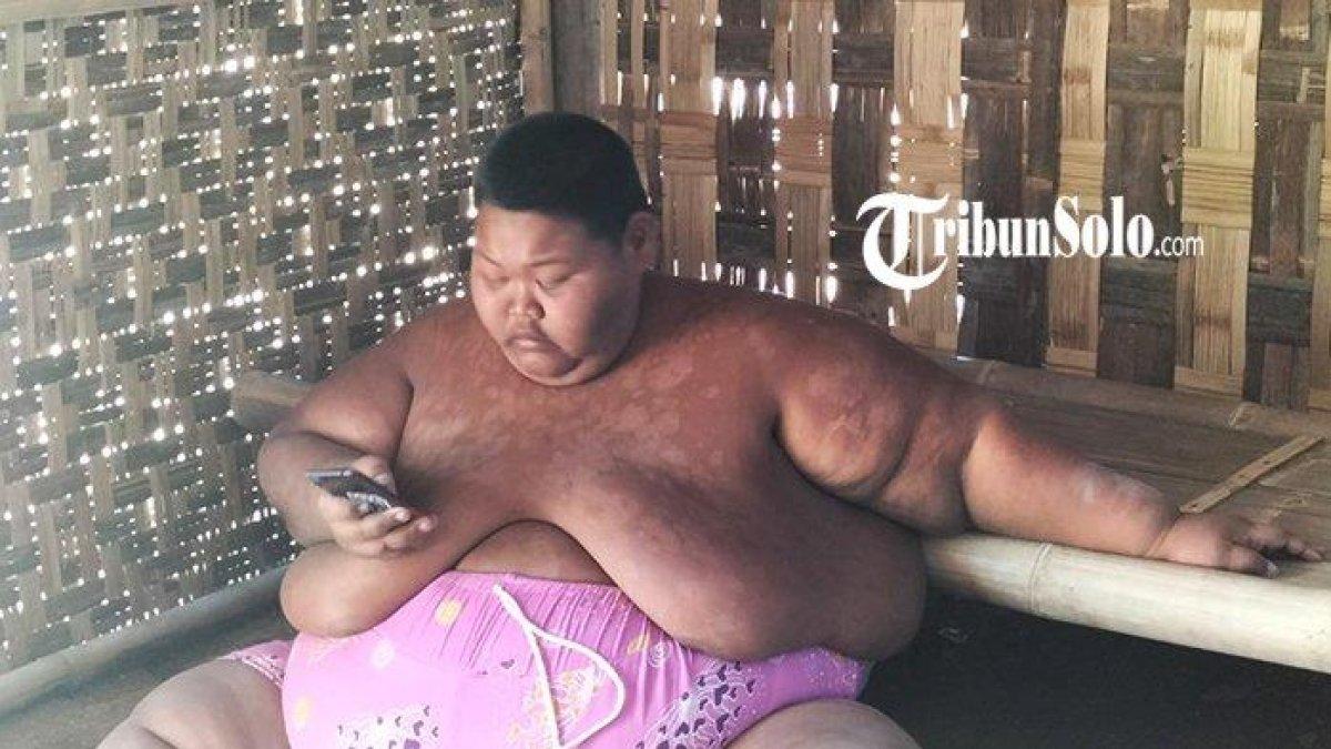 Sungadi, pemuda asal Desa Sono, Kecamatan Mondokan, Kabupaten Sragen yang mengidap obesitas