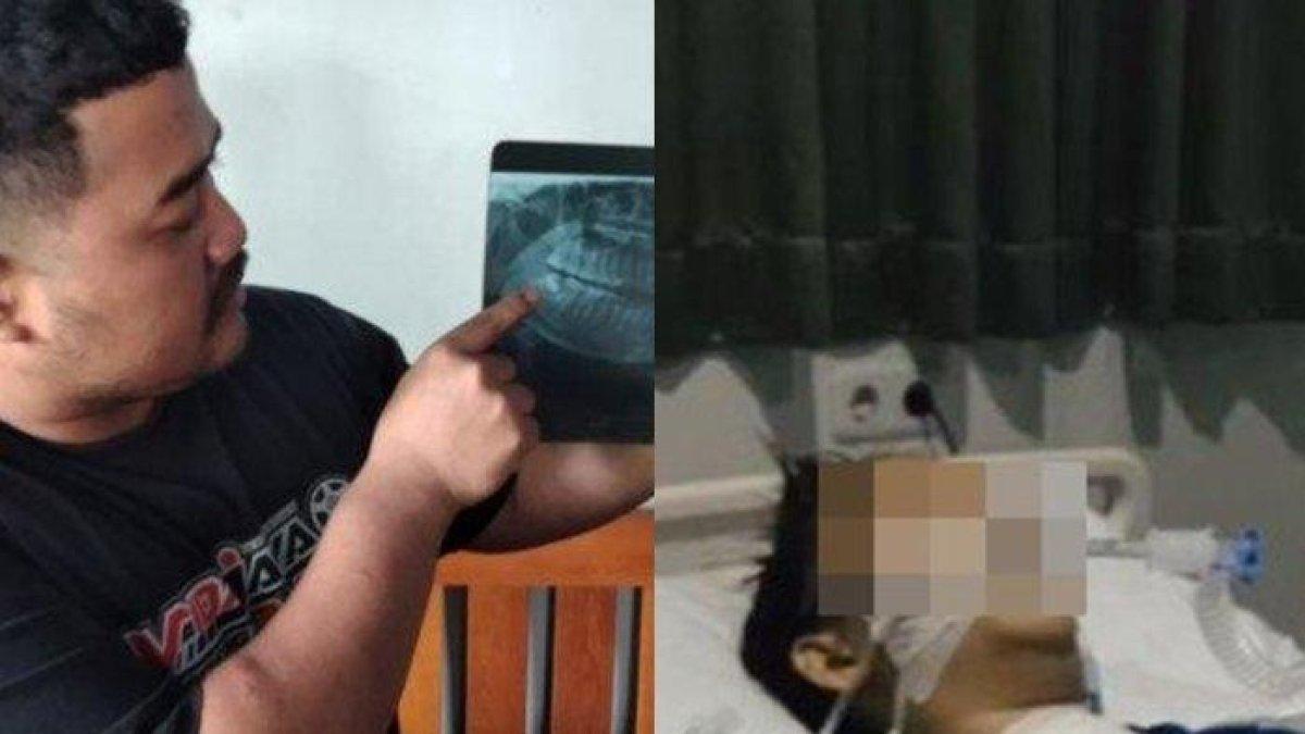 Tengah viral dimedia sosial curhatan seorang pria bernama Davin Ahmad Sofyan (28), kehilangan istri tercintanya Nira Pranita Asih (31), usai cabut gigi bungsu.