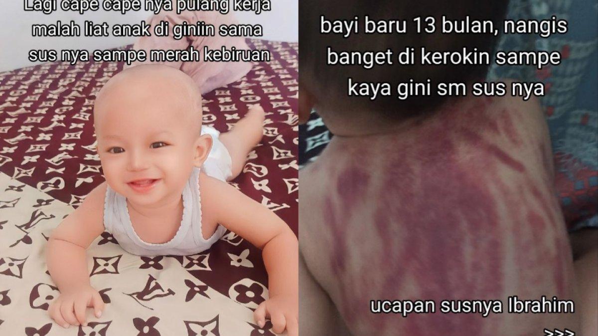 Tia syok mendapati anaknya yang masih bayi dikeroki oleh pengasuh