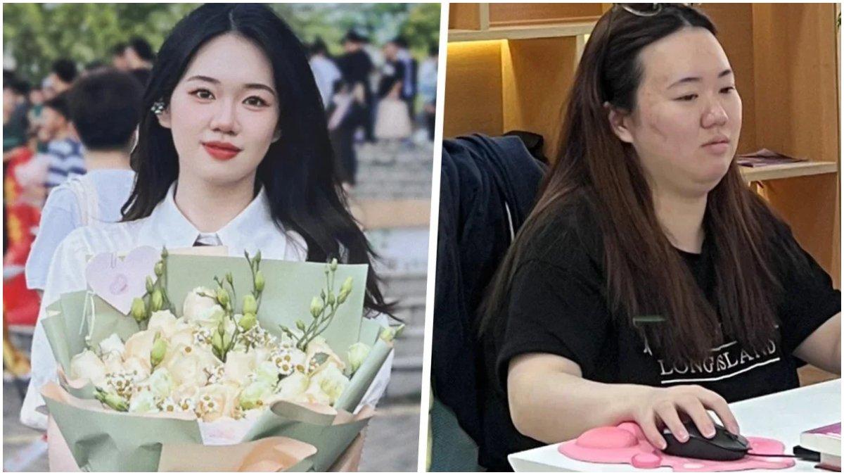 Transformasi Ouyang (24) stres bekerja naik bb 20 kg dalam setahun.