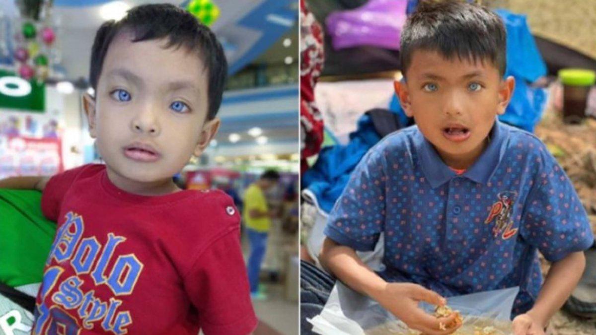 Viral di media sosial seorang bocah lelaki memiliki mata berwarna biru, orangtua syok langsung cek silsilah keluarga