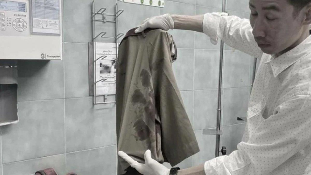 Viral organ pribadi seorang pelajar terluka setelah pistol pena yang disimpan di saku celana meledak