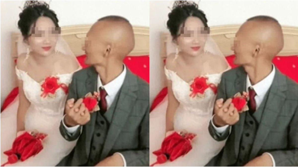Viral pengantin cantik dinyinyiri matre gara-gara dinikahi pria ompong (2)