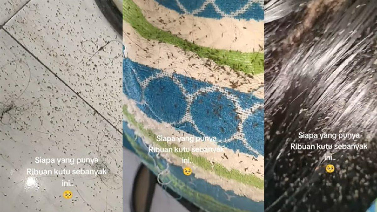 Viral ribuan kutu bersarang di rambut bocah ini