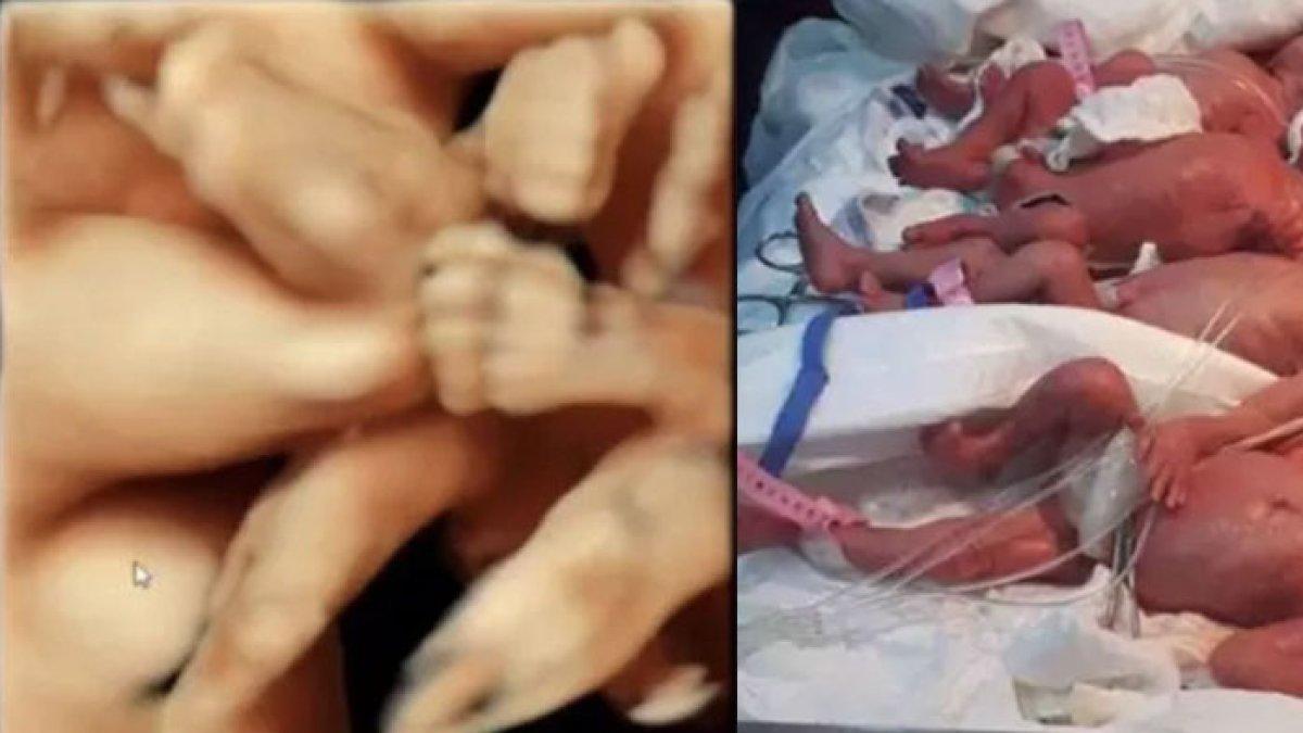 Viral wanita di Brazil berhasil melahirkan enam bayi kembar hanya dalam waktu 10 menit, ada bayi yang seukuran telapak tangan