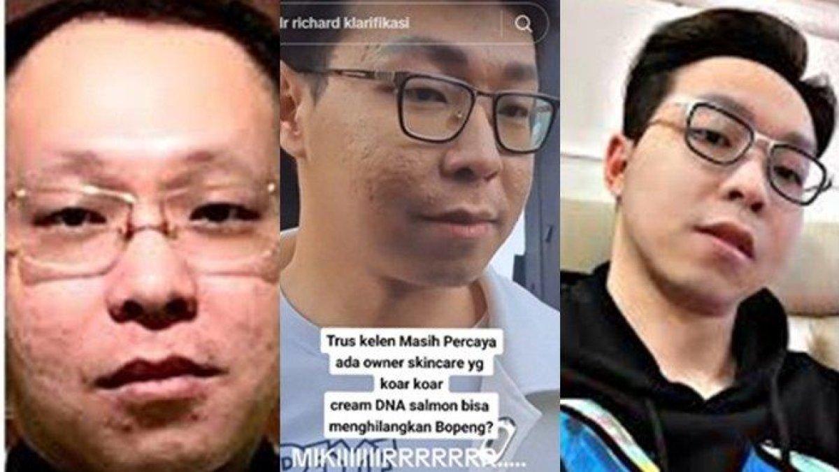 Wajah Asli Richard Lee Dihujat tak Seglowing di Kamera.