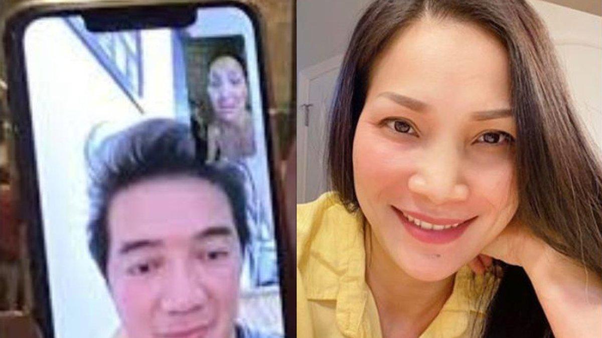 Wajah Hong Ngoc sekarang setelah 4 tahun lalu alami luka bakar