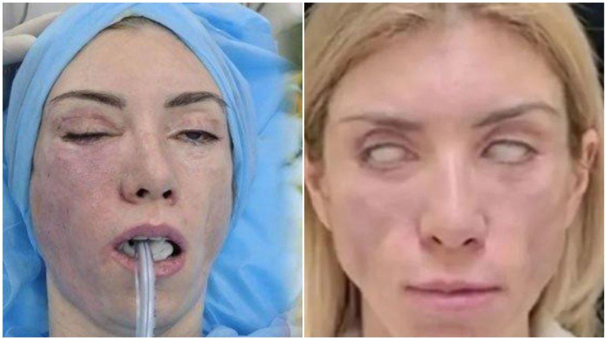 Wajah Yulia Tarasevich usai dioplas