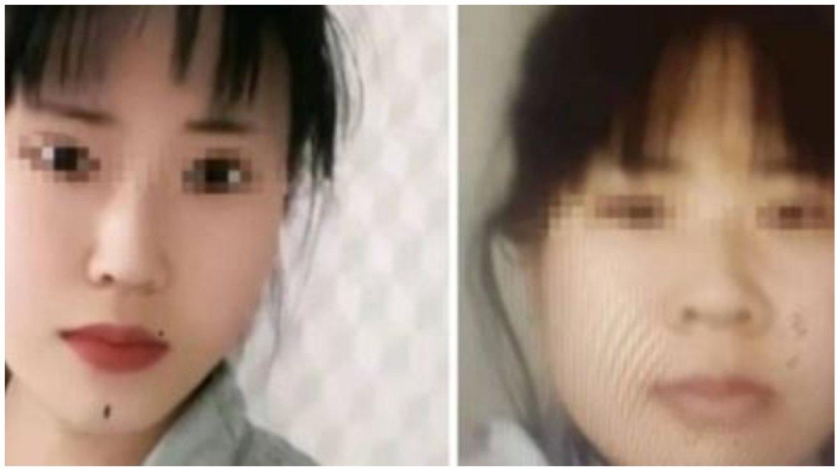 Wanita muda nekat oplas namun berakhir bunuh diri