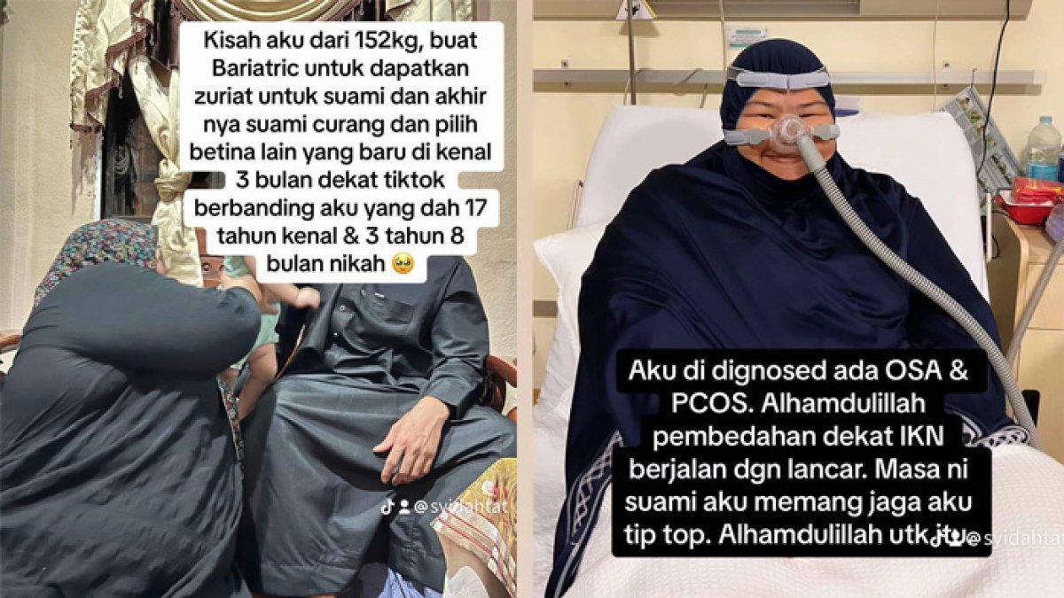 Wanita rela jalani operasi bariatrik demi punya anak, malah diselingkuhi suami