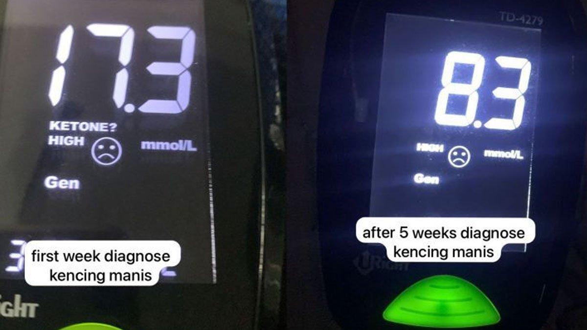 Wanita sedih saat dirinya didiagnosa sakit kencing manis.