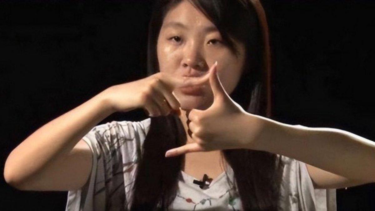 Wanita terlahir bisa dan tuli tiba-tiba bisa bicara setelah menikah.