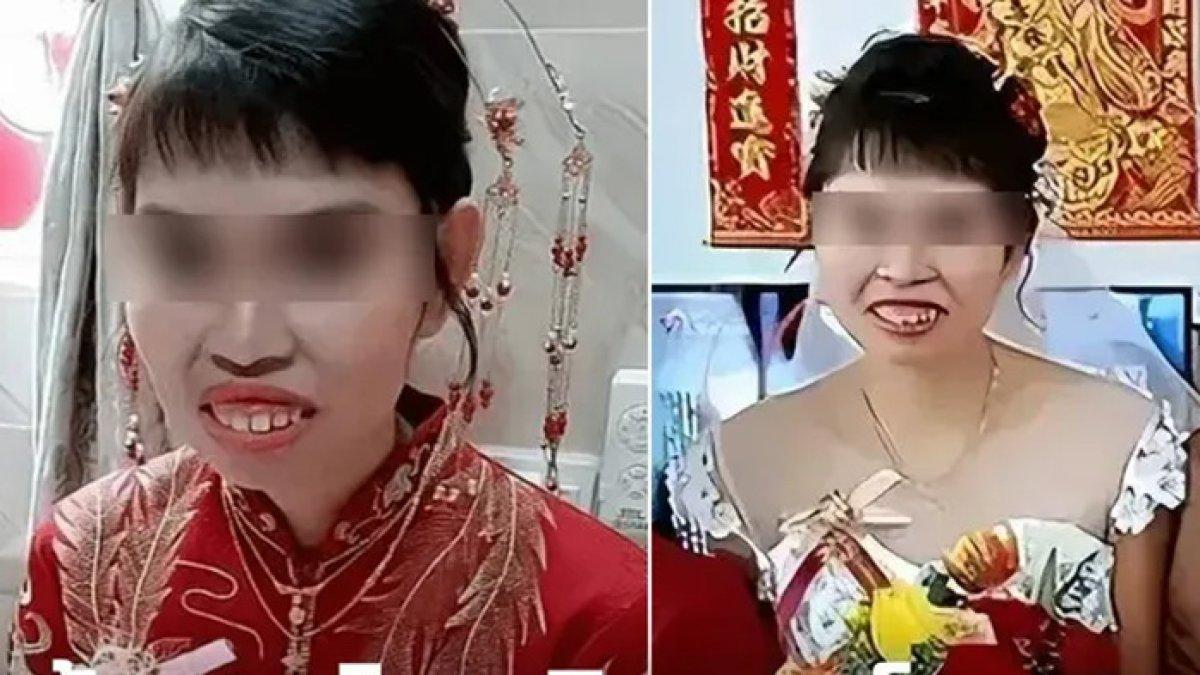 Xiao Meng bahagia akhirnya menikah tapi parasnya dihina