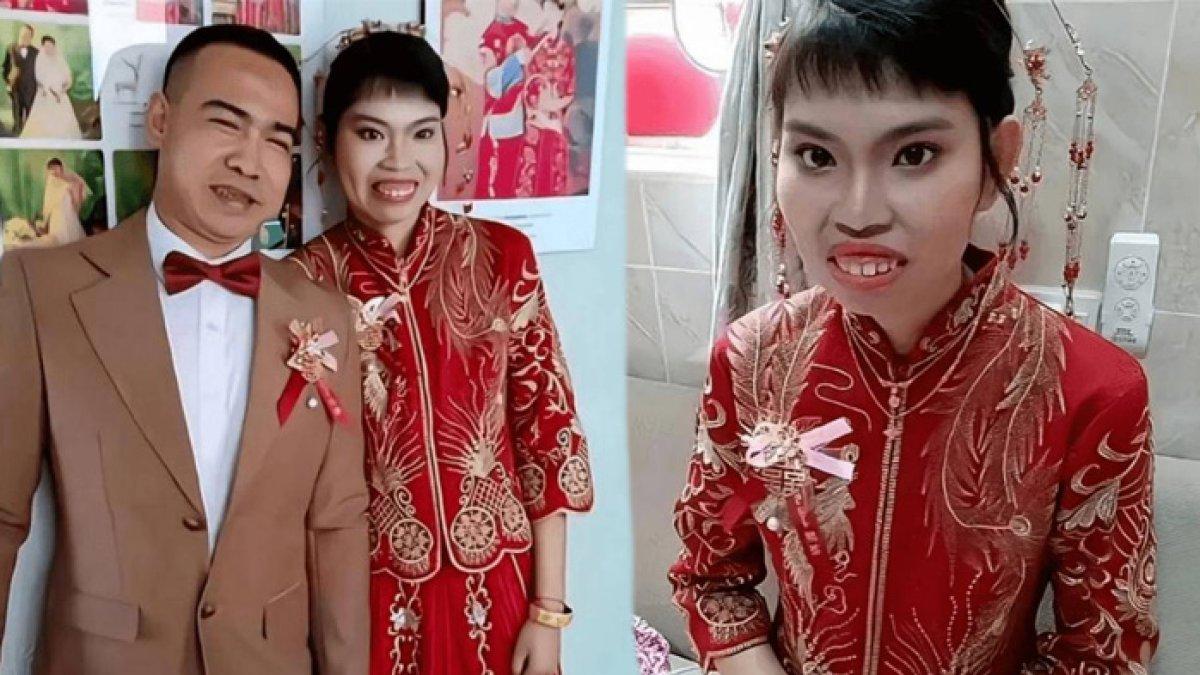 Xiao Meng bahagia akhirnya menikah tapi parasnya dihina netizen, suami pasang badan
