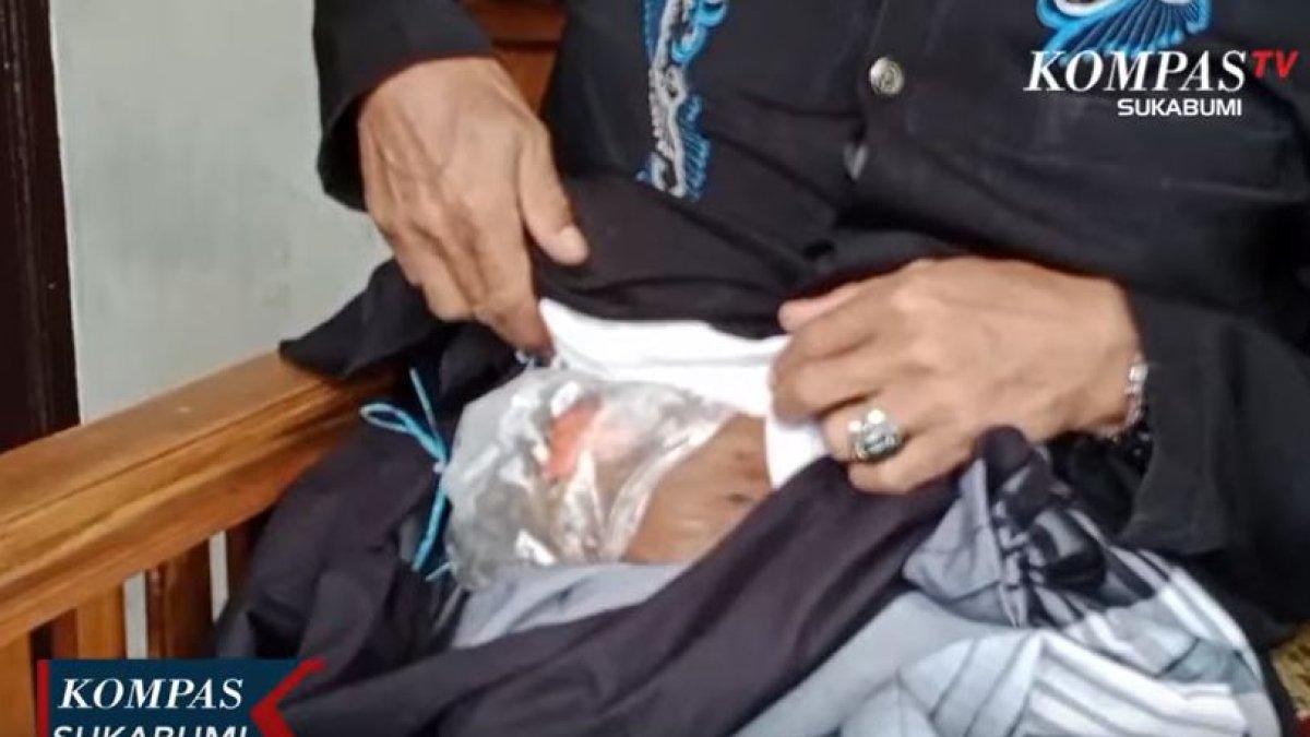 Yayat terpaksa tutup ususnya yang bocor pakai kresek