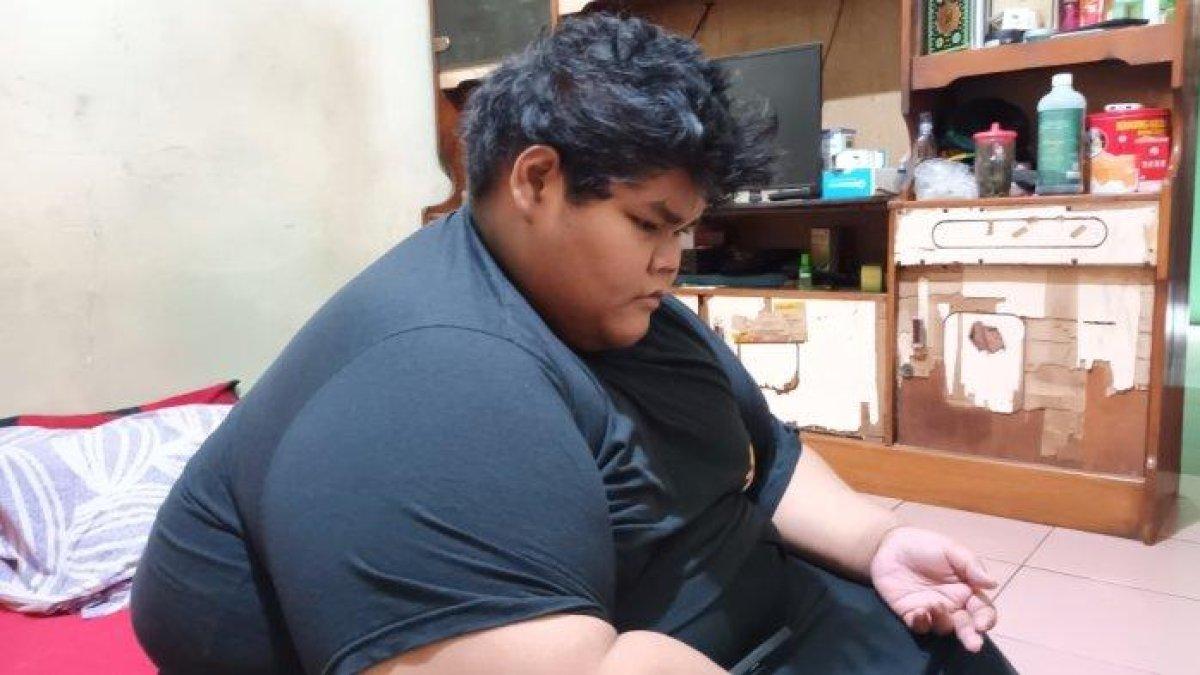 Ahmad Juwanto, pemuda 19 tahun di Cipayung, Jakarta Timur, mengalami obesitas