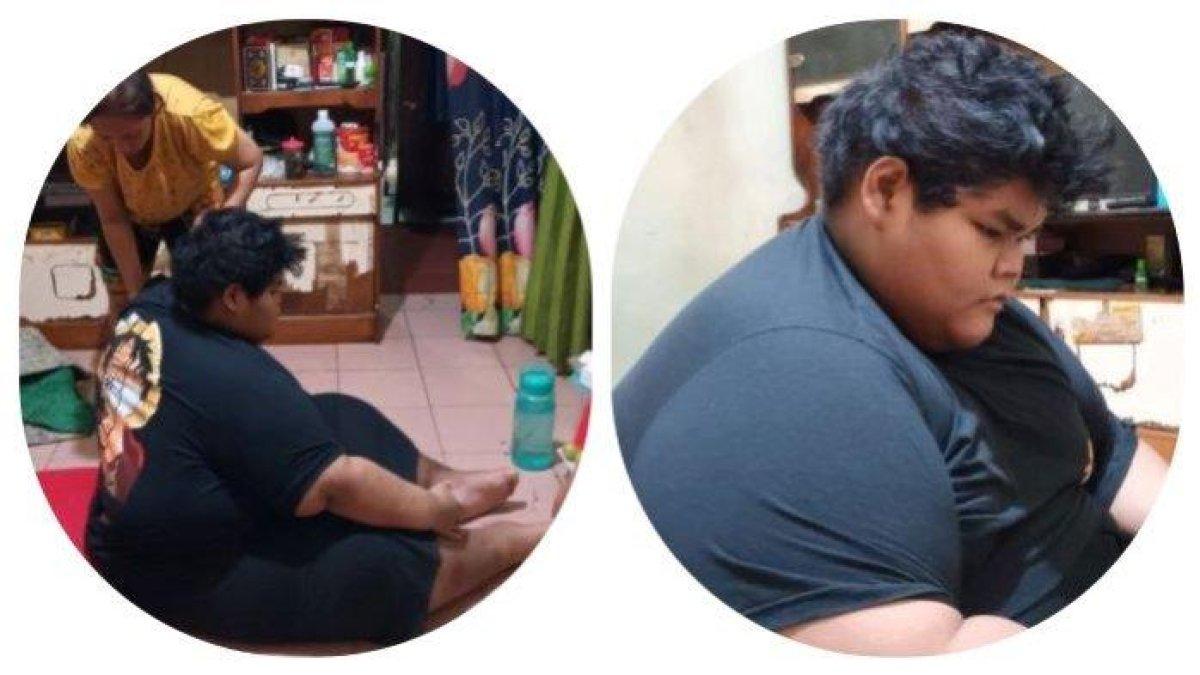 Ahmad Juwanto, pemuda 19 tahun di Cipayung, Jakarta Timur, mengalami obesitas