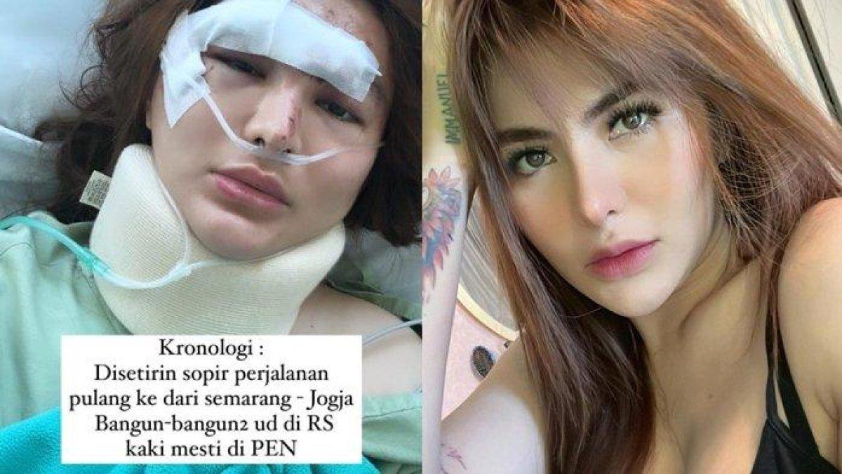 Angela Lee kecelakaan. Wajah sang artis kini lebam, dahinya ditempeli perban, sedangkan hidungnya dipasangi alat bantu pernapasan.