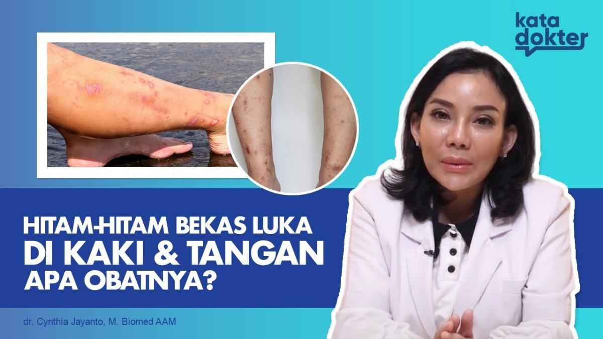 5 Cara Mengobati Bekas Luka Dengan Terapi Laser, Perawatan Kulit