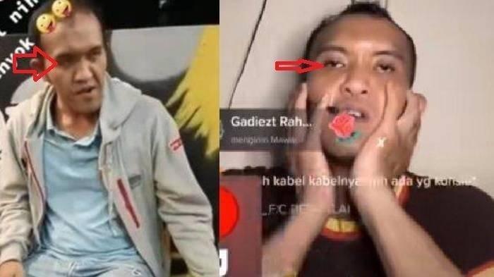 Pengakuan Caisar YKS setelah viral joget 24 jam di live TikTok hingga dipanggil BNN, dituding konsumsi narkoba.