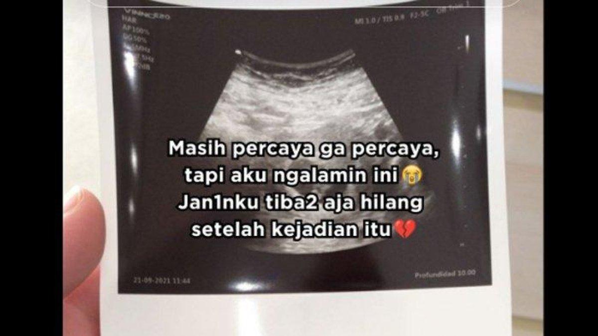 cerita seorang wanita yang kehilangan janinnya usai bertemu sosok misterius