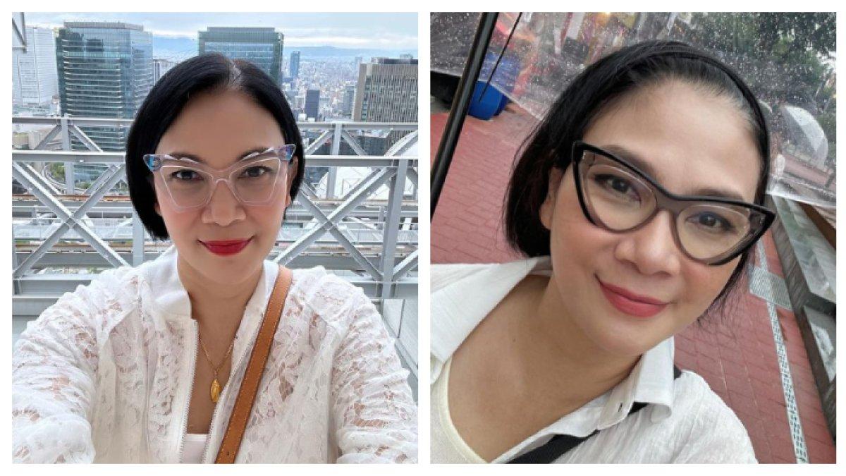 Dian Nitami melakukan oplas untuk menghilangkan kerutan dan kantung mata.