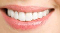 4 cara alami memutihkan gigi kuning ampuh