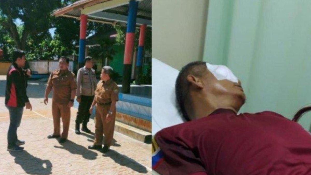 Guru di Bengkulu dioperasi gegara diketapel orang tua murid