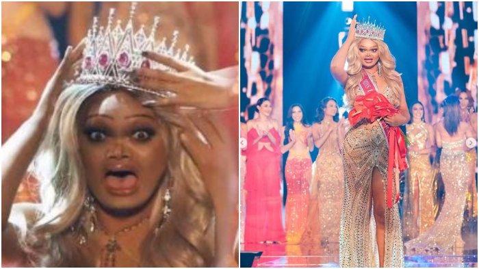 Juara ratu kecantikan ini aslinya botak dan ompong, tapi sukses kalahkan saingannya yang cantik-cantik
