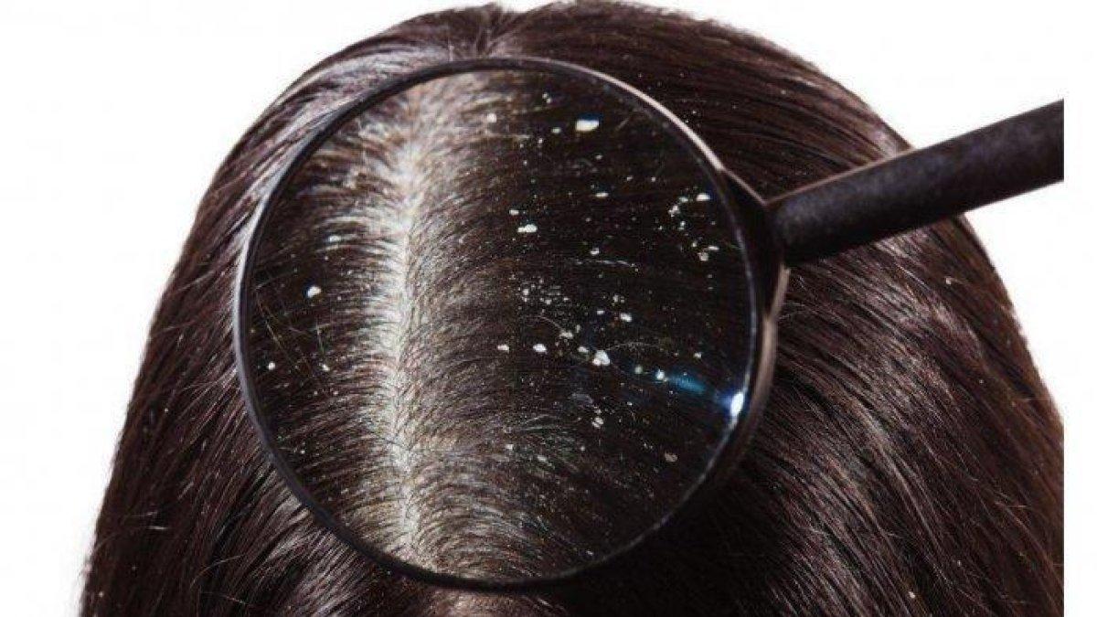 manfaat kangkung untuk ketombe