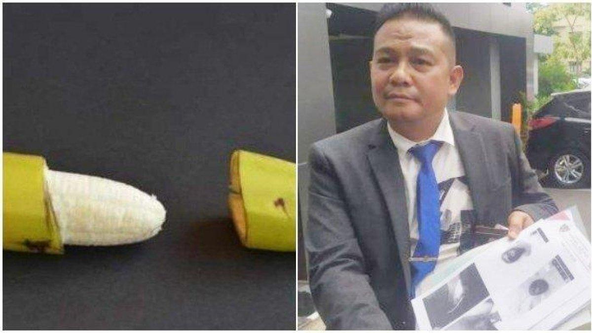 kuasa hukum korban saat menjelaskan kronologi kemaluan terpotong saat sunat