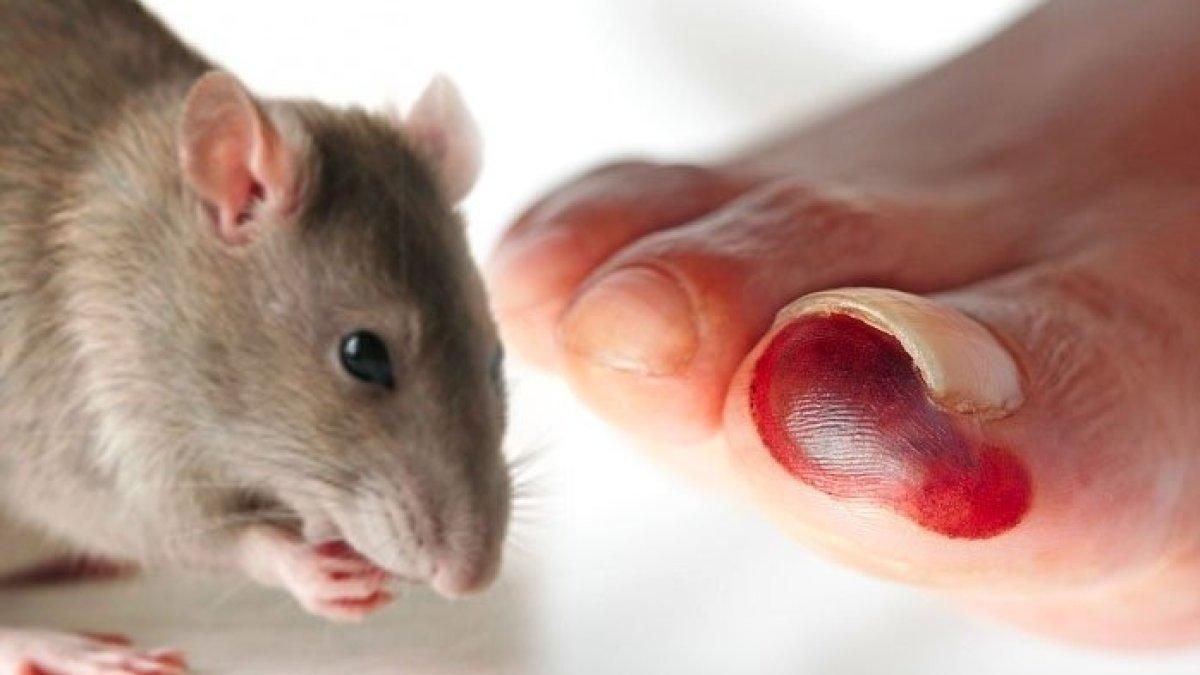 leptopirosis salah satu penyakit menular saat musim hujan