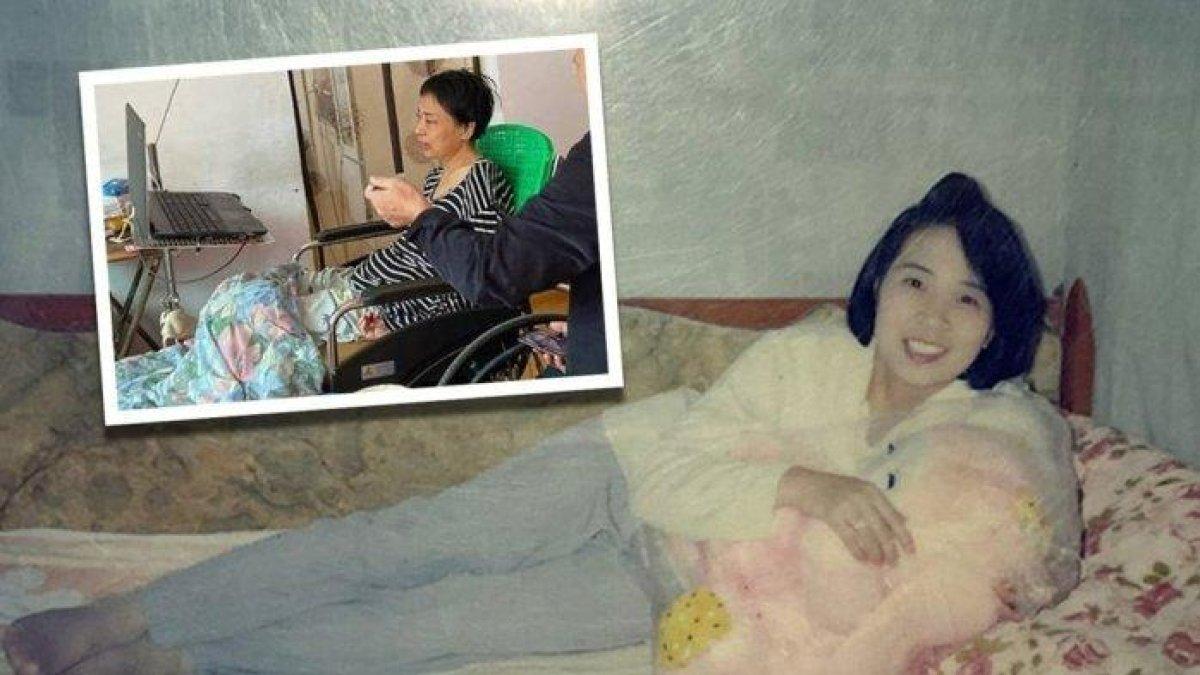 Li Xiaozhong, wanita di China yang lumpuh, hanya bisa bergantung pada suami