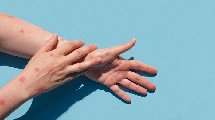 cegah infeksi dengan daun bidara