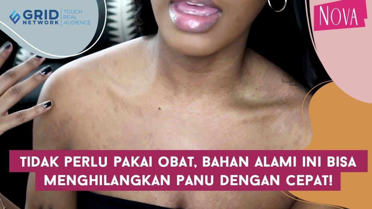 5 cara mengobati secara alami