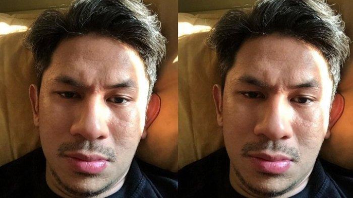 Profil Aji Yusman, artis yang tidak ada biaya untuk operasi anak saat meninggal dalam kandungan.