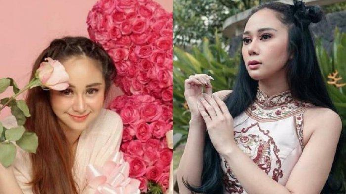 Selebgram Denise Chariesta