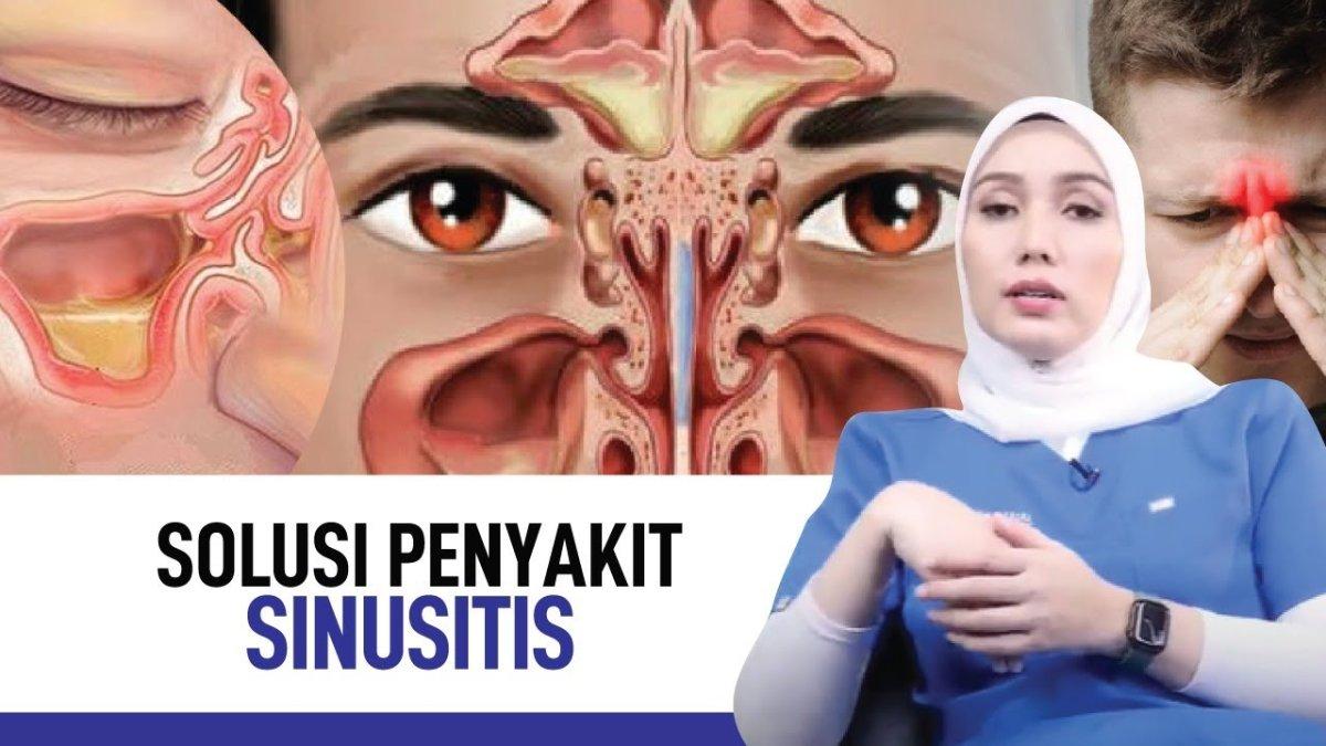 7 cara alamim obati sinus