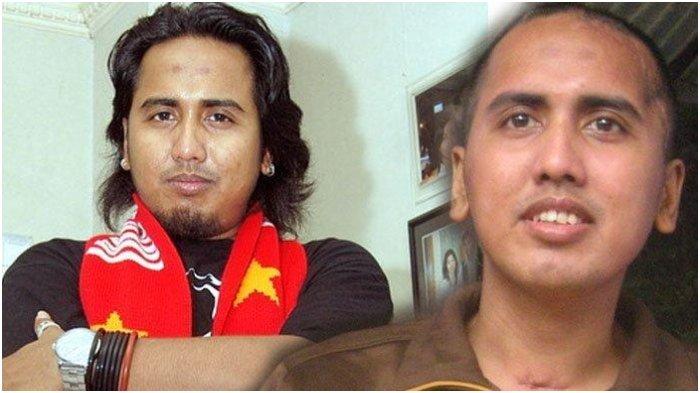 KABAR GUGUN GONDRONG - Gugun Gondrong pernah mengidap tumor otak hingga sebagian ingatannya menghilang. Kini ia sudah sembuh namun tak bisa seperti dulu lagi.