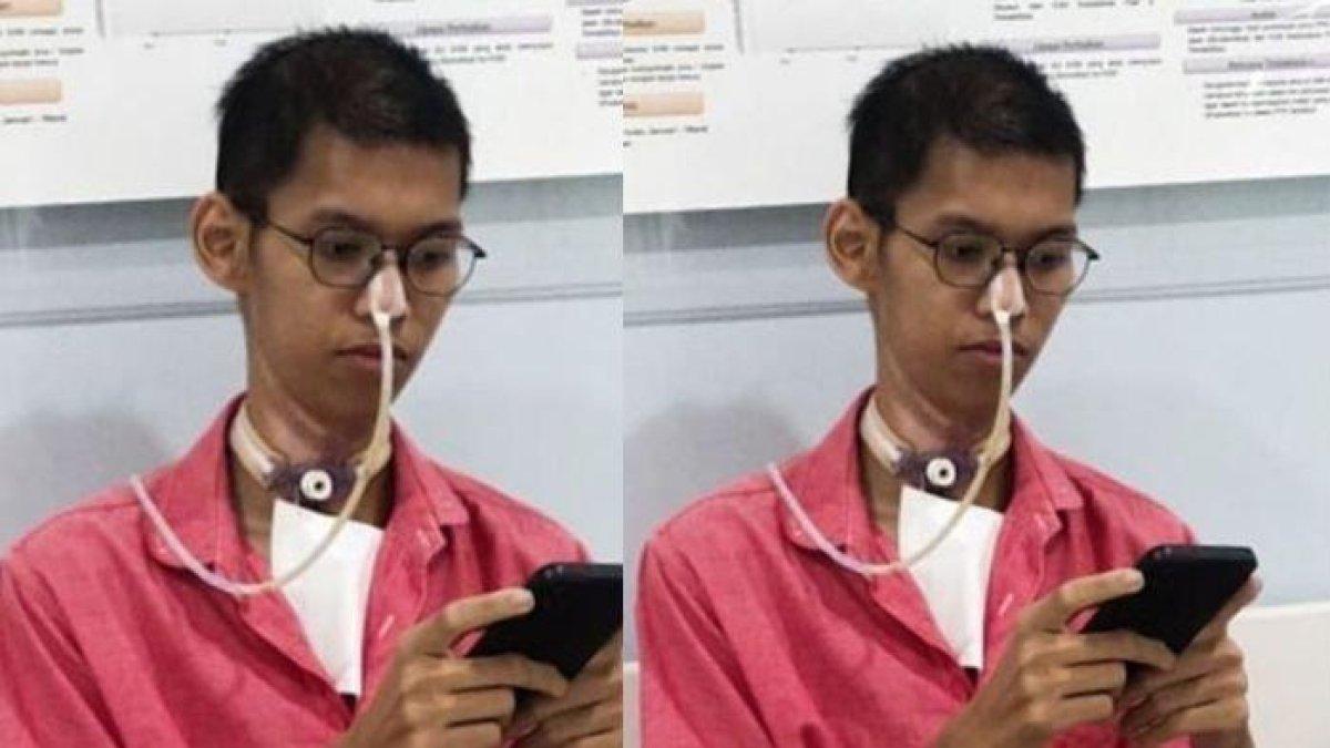 Sultan Rifat, mahasiswa UB Malang yang lehernya terjerat kabel fiber optik