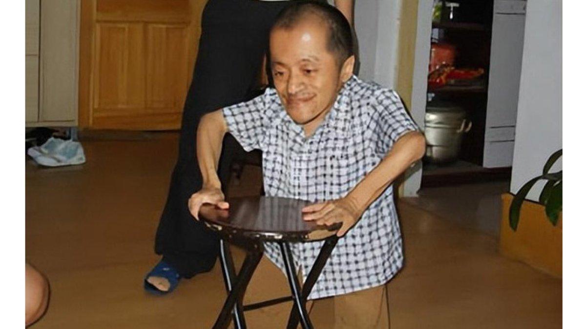Tan Xuan Huy, pria kerdil dengan tinggi badan 70 cm