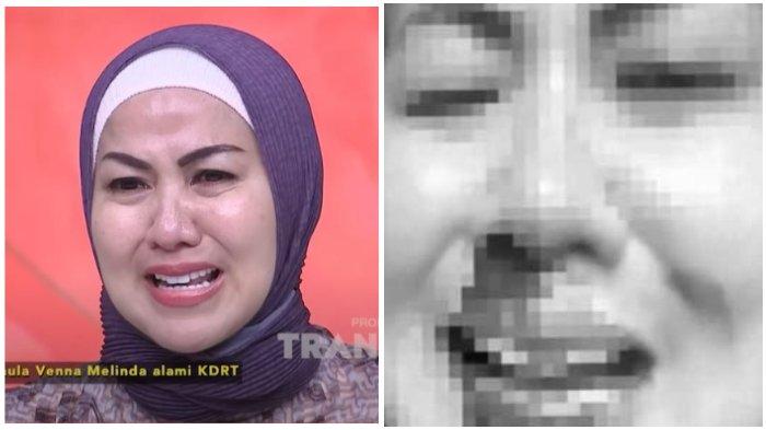 Venna Melinda akhirnya bongkar borok Ferry Irawan yang sering KDRT