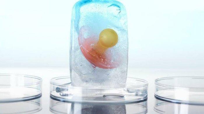EGG FREEZING -  Egg freezing menjadi perbincangan  saat artis Luna Maya dipersunting oleh Maxime Bouttier.
Sebelum menikah, Luna Maya diketahui sudah melakukan tindakan pembekuan sel telur atau egg freezing.